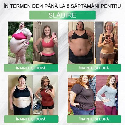🏆Au mai rămas doar 5 cutii! Profită acum de încă 50% reducere! Recapătă-ți silueta și sănătatea! Dacă ratezi această oportunitate acum, la anul s-ar putea să fie prea târziu! 💥🔥