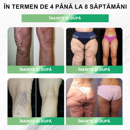 🏆Au mai rămas doar 5 cutii! Profită acum de încă 50% reducere! Recapătă-ți silueta și sănătatea! Dacă ratezi această oportunitate acum, la anul s-ar putea să fie prea târziu! 💥🔥